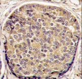 Polyclonal Rabbit anti-Human PIK3CB / PI3K Beta Antibody (aa713-744, IHC, WB)