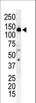 Polyclonal Rabbit anti-Human PIK3R4 Antibody (aa53-83, IHC, WB)