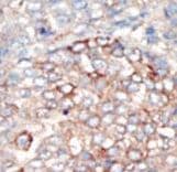 Polyclonal Rabbit anti-Human PIK3R4 Antibody (aa53-83, IHC, WB)