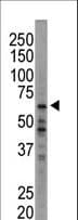 EIF2AK1 Antibody (aa1-30)