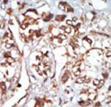 EIF2AK1 Antibody (aa1-30)