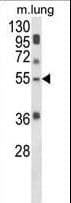 Polyclonal Rabbit anti-Human Selenium Binding Protein 1 Antibody (aa317-344, WB)