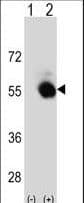 Polyclonal Rabbit anti-Human Selenium Binding Protein 1 Antibody (aa317-344, WB)