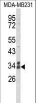 Polyclonal Rabbit anti-Human CLTA / LCA Antibody (aa99-127, IHC, WB)