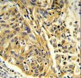 Polyclonal Rabbit anti-Human CLTA / LCA Antibody (aa99-127, IHC, WB)