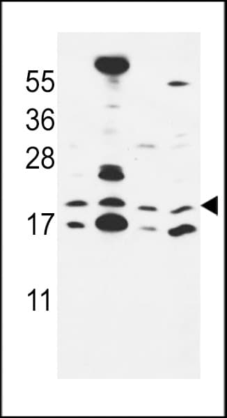 Polyclonal Rabbit anti-Human Cnpy2 / TMEM4 Antibody (aa134-162, WB)