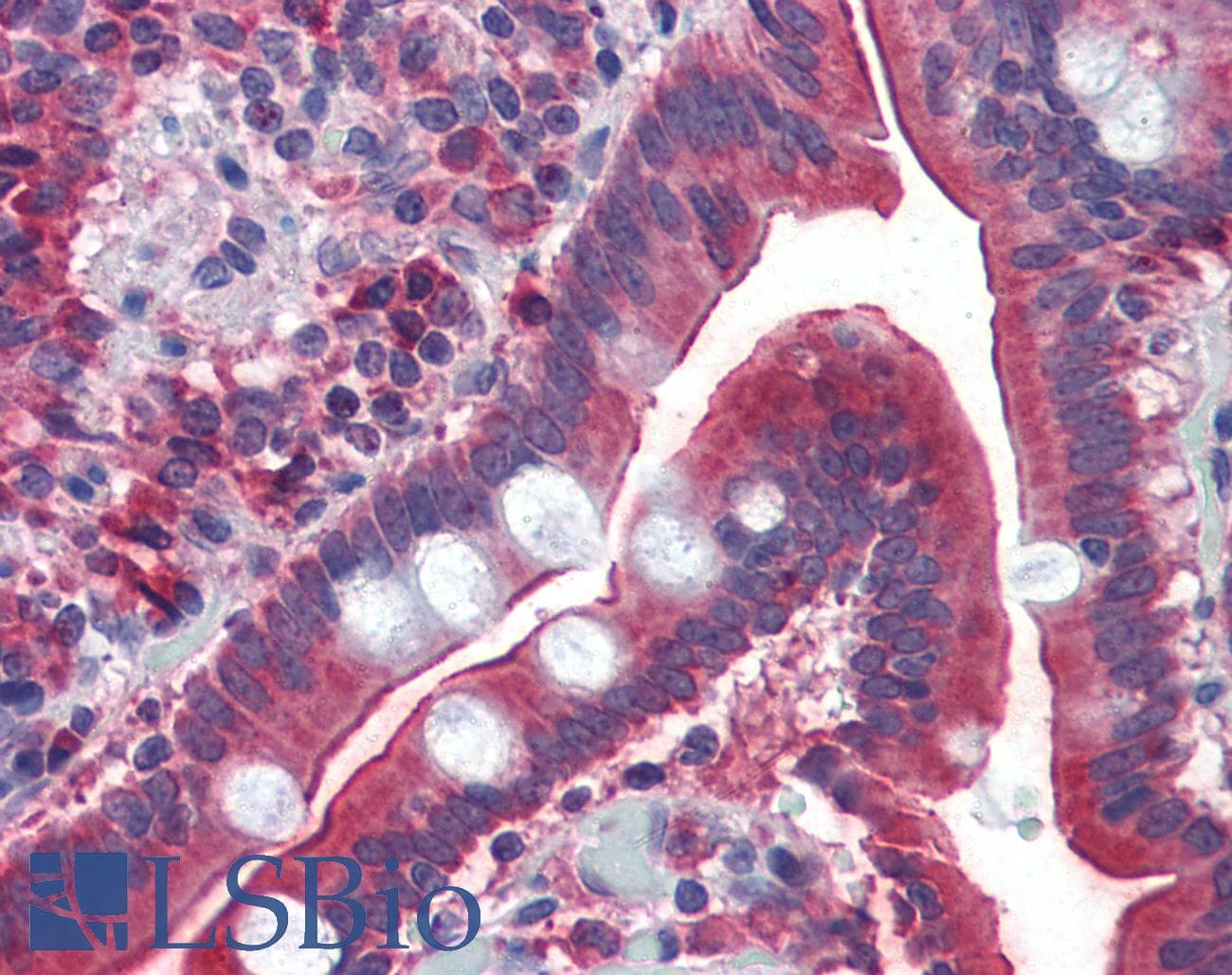 Polyclonal Rabbit anti-Human GATA6 Antibody (FITC, C-Terminus, IHC, WB)