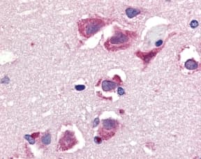TNFSF10 / TRAIL Antibody (C-terminal)