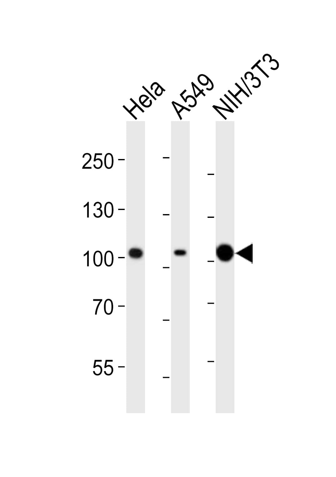 Monoclonal Mouse anti-Human FER Antibody (clone 1457CT181.12.17, WB)