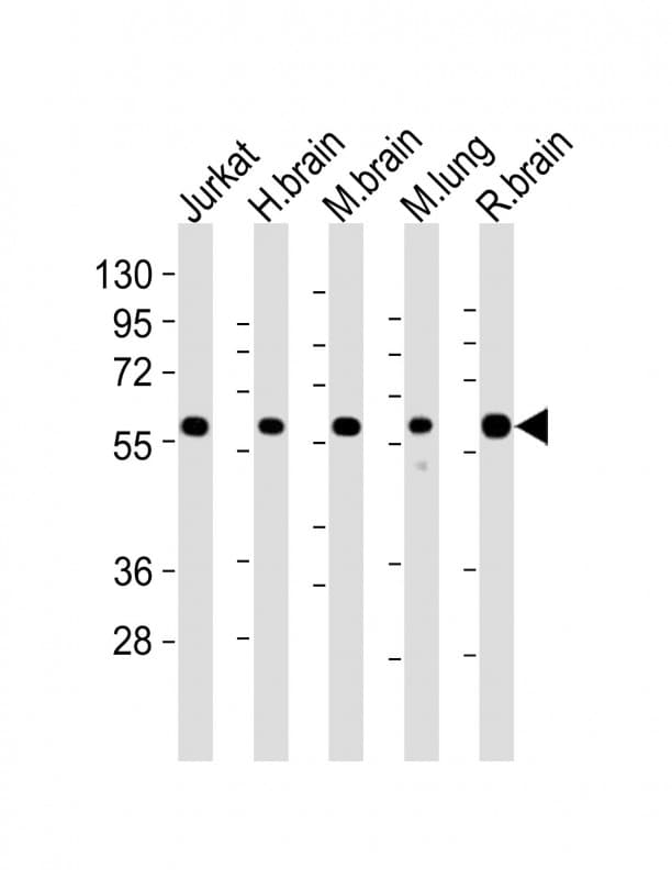 Monoclonal Mouse anti-Human PPP2R1B Antibody (clone 1496CT356.164.25.226, WB)