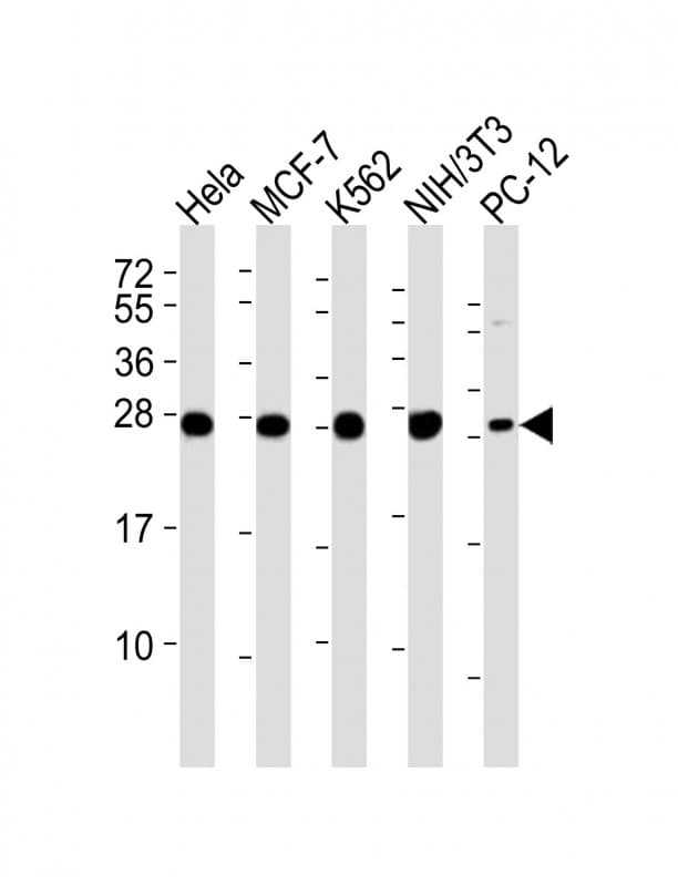 Monoclonal Mouse anti-Human EIF4E Antibody (clone 1504CT774.14.55, WB)