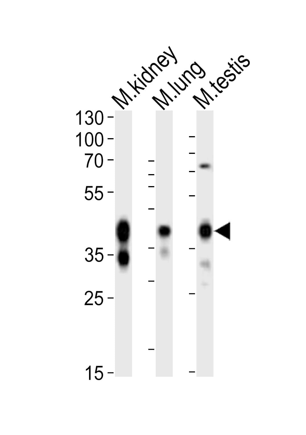 EPCAM Antibody (aa302-335)