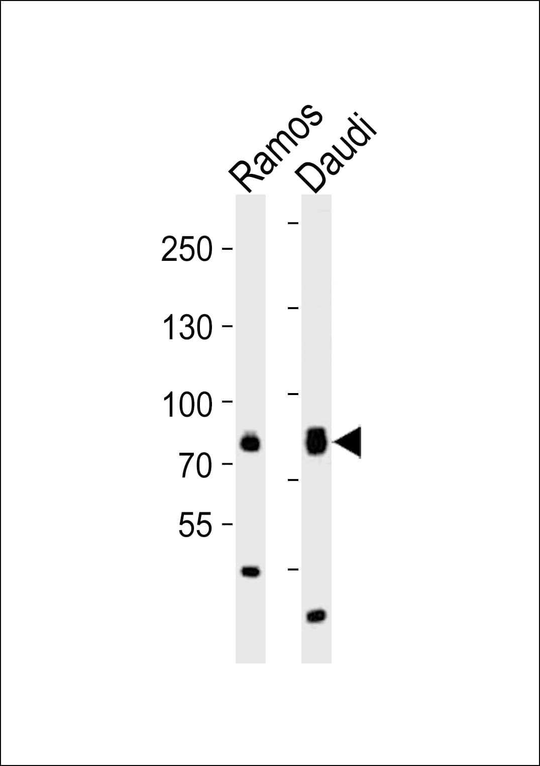 Polyclonal Rabbit anti-Human TEC Antibody (aa254-288, WB)