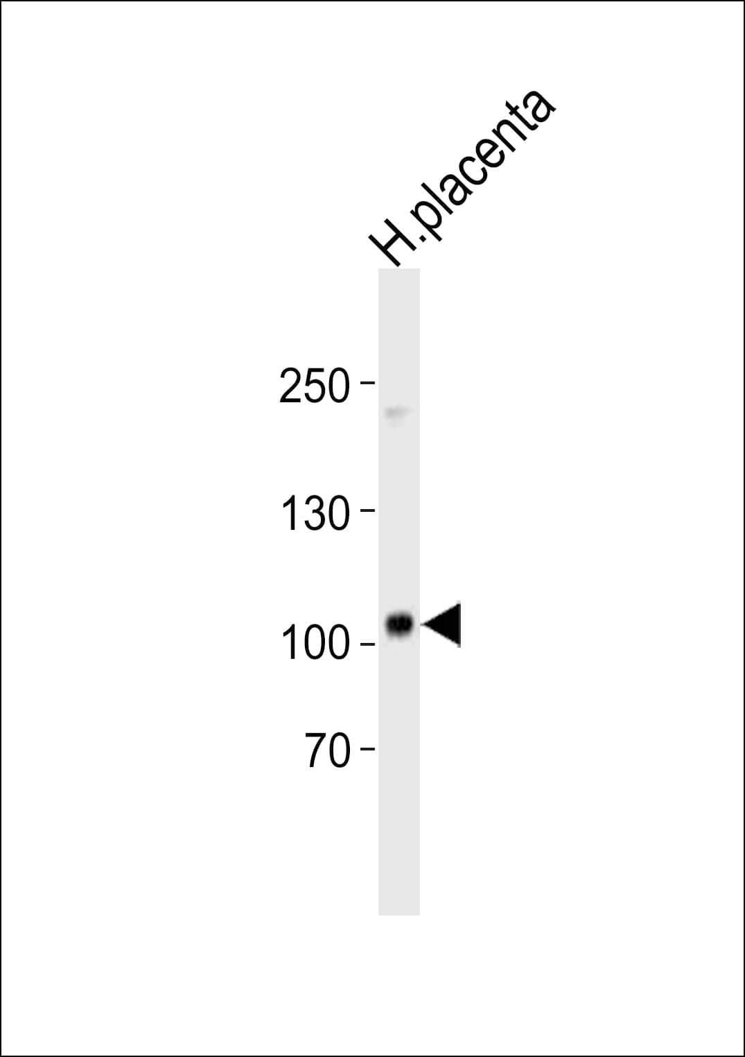 CD105 Antibody (aa284-318)