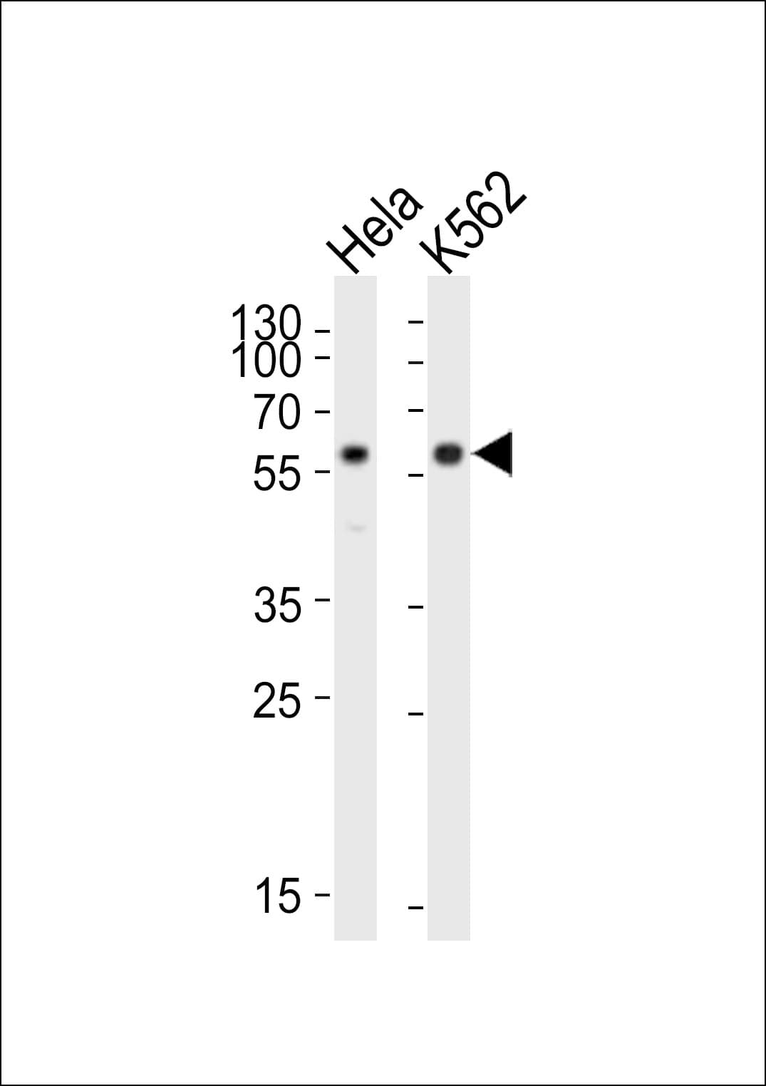 Polyclonal Rabbit anti-Mouse CDK8 Antibody (aa424-458, WB)