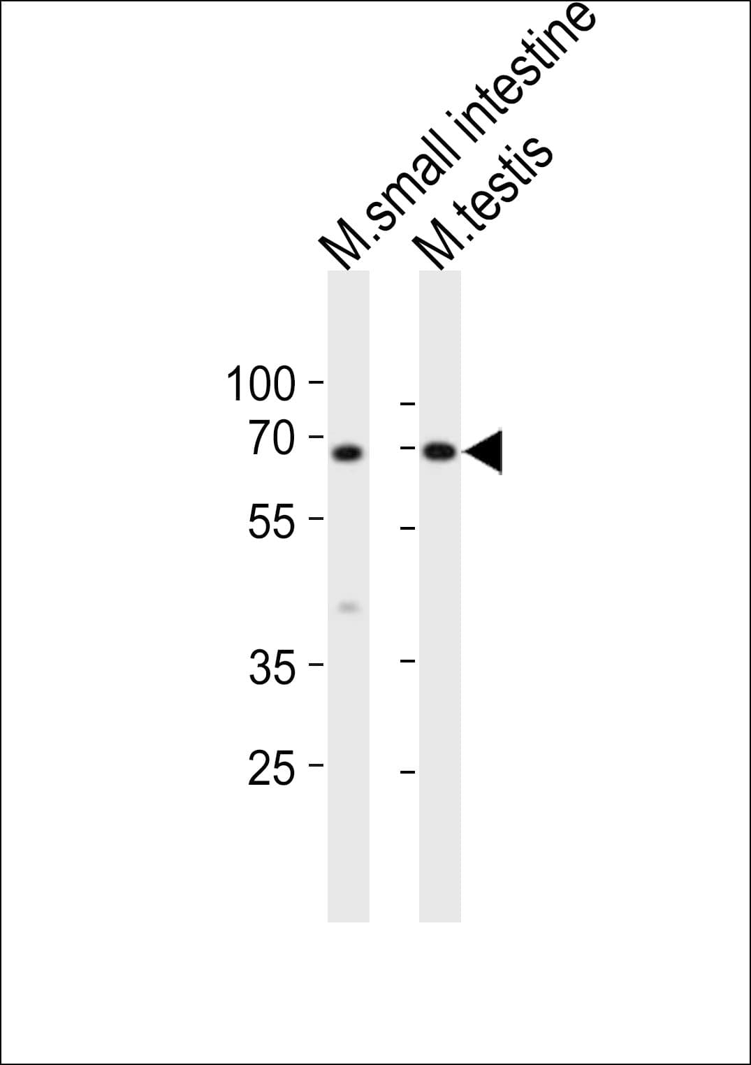 Polyclonal Rabbit anti-Mouse KLF4 Antibody (aa321-354, WB)