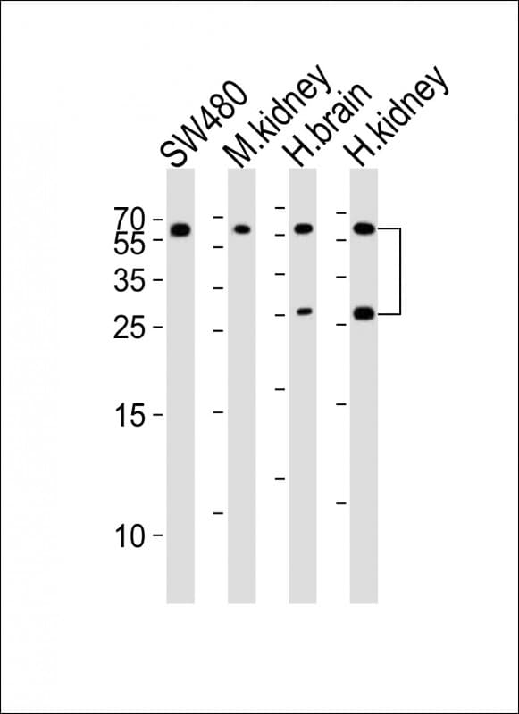 Polyclonal Rabbit anti-Human FGF9 Antibody (WB)