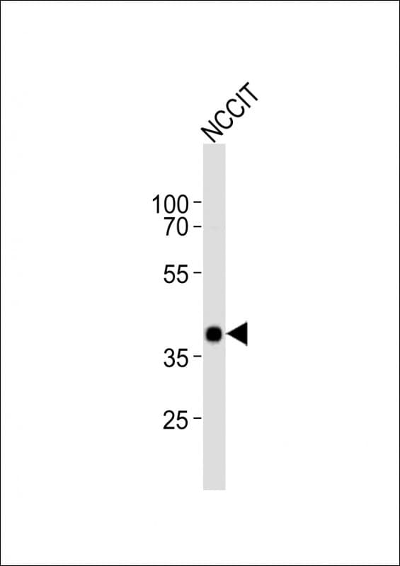 Polyclonal Rabbit anti-Human DPPA4 Antibody (aa107-142, WB)