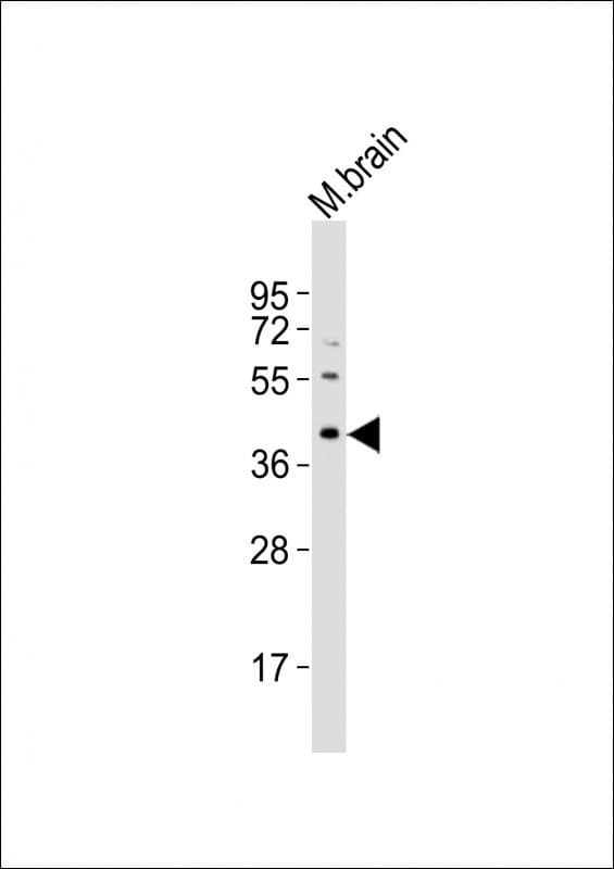 Polyclonal Rabbit anti-Mouse RAD9A / RAD9 Antibody (aa29-62, WB)