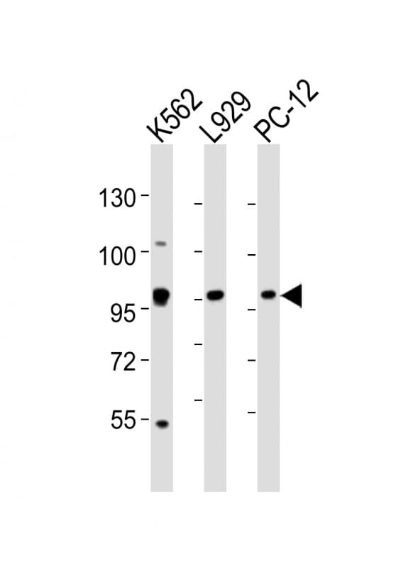 Polyclonal Rabbit anti-Human STAT5A Antibody (aa763-797, WB)