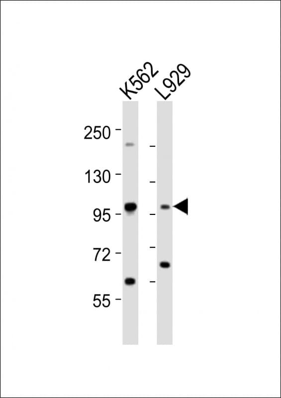 Polyclonal Rabbit anti-Human STAT5A Antibody (aa763-797, WB)