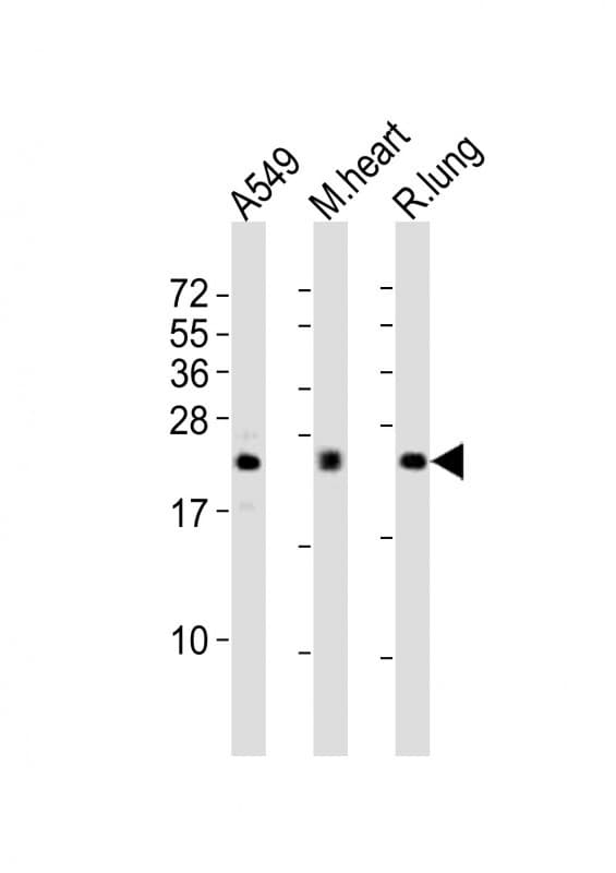 Polyclonal Rabbit anti-Human FGF2 / Basic FGF Antibody (WB)
