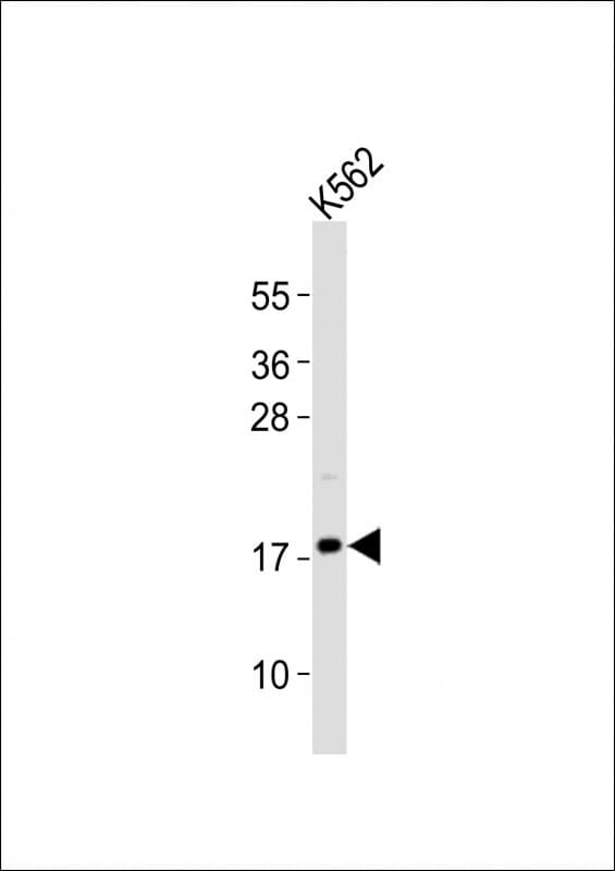 Polyclonal Rabbit anti-Human FGF2 / Basic FGF Antibody (WB)