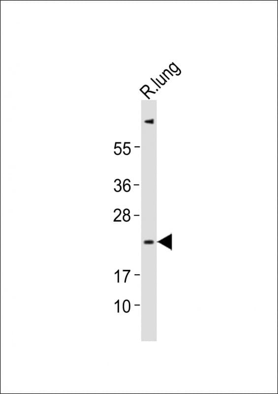 Polyclonal Rabbit anti-Mouse CTF1 / Cardiotrophin-1 Antibody (WB)