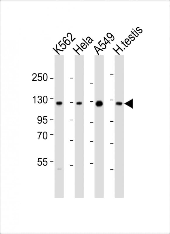 SIRT1 / Sirtuin 1 Antibody (aa587-621)