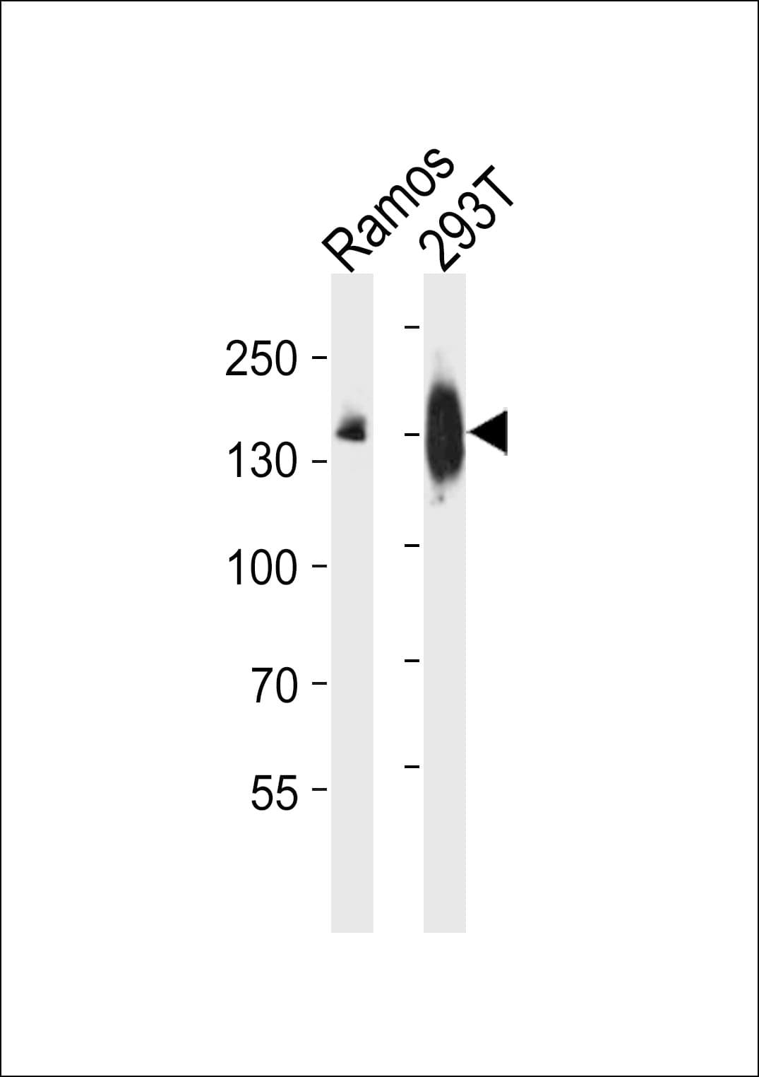 Polyclonal Rabbit anti-Human PLCG2 / PLC Gamma 2 Antibody (WB)