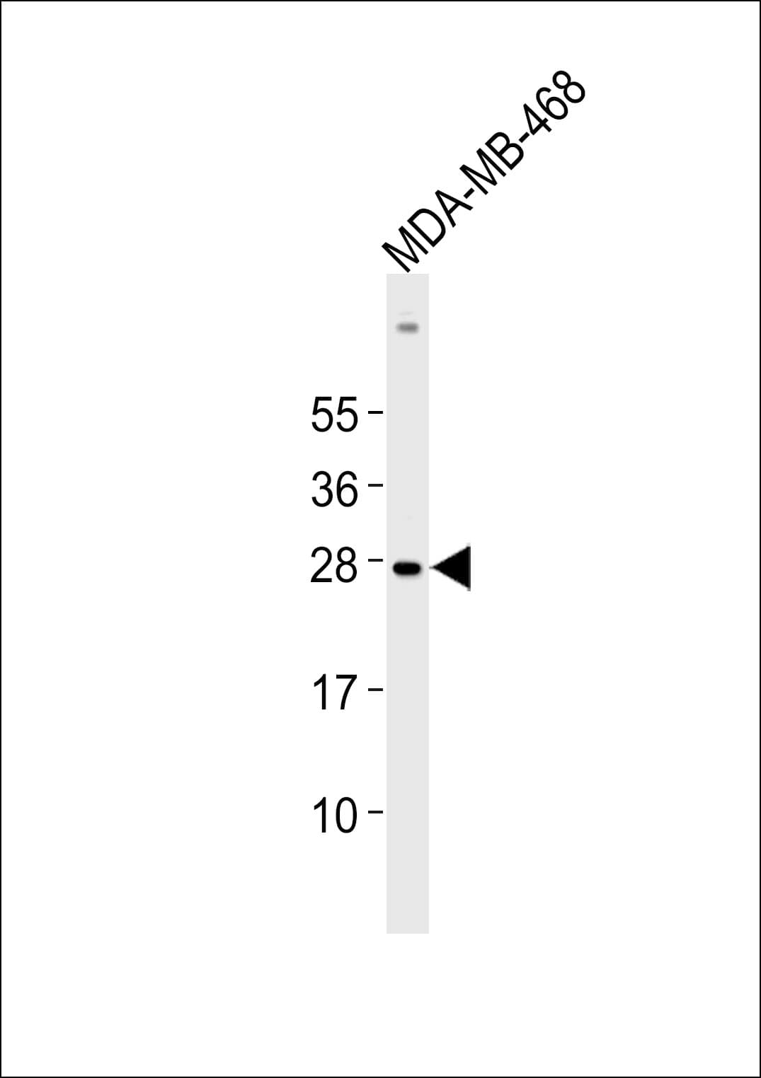 Polyclonal Rabbit anti-Human CSNK2B / Phosvitin Antibody (WB)
