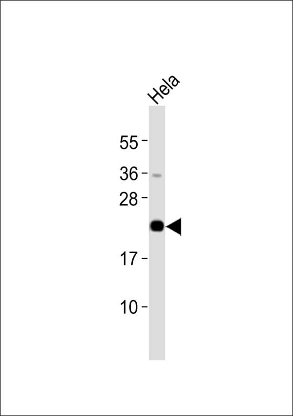 CSRP1 Antibody