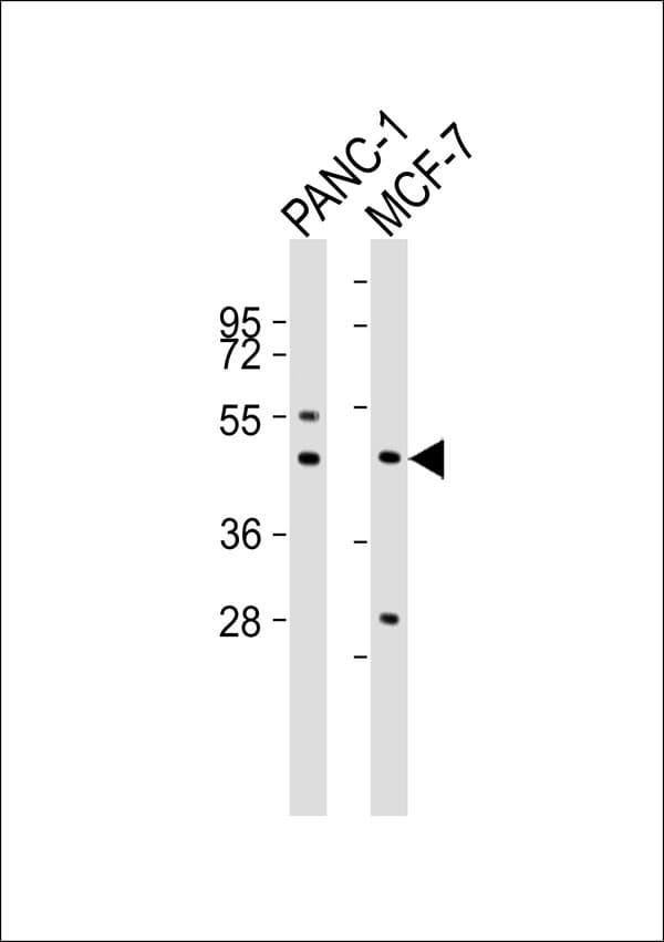 Polyclonal Rabbit anti-Human CTSD / Cathepsin D Antibody (WB)