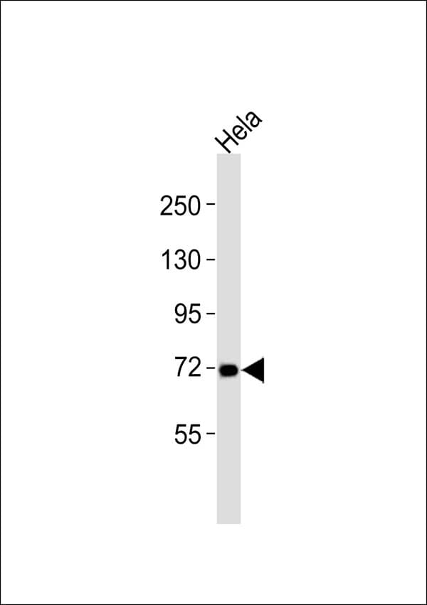 Polyclonal Rabbit anti-Human MMP15 Antibody (WB)