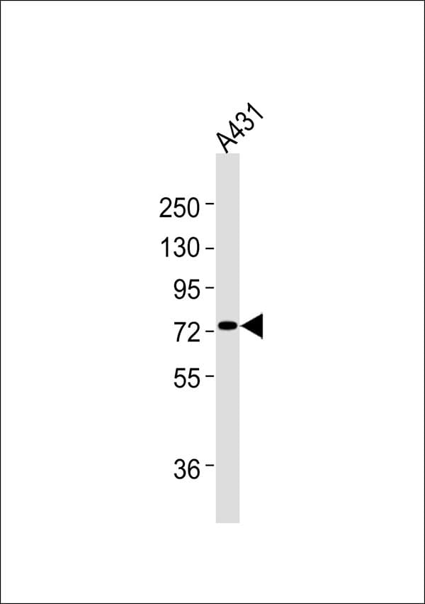 Polyclonal Rabbit anti-Human PFKL Antibody (WB)
