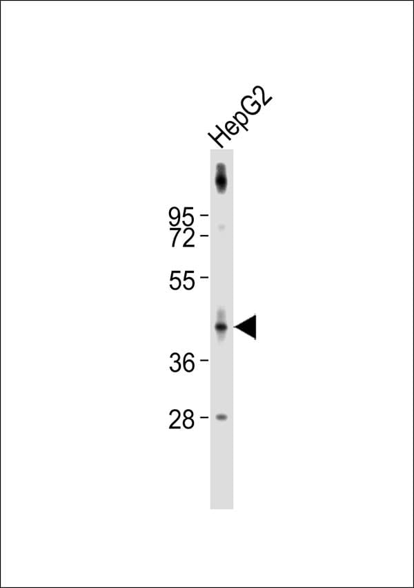 Polyclonal Rabbit anti-Human SERPINB4 / SCCA1+2 Antibody (WB)