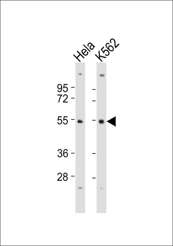 Polyclonal Rabbit anti-Human SKP2 Antibody (WB)