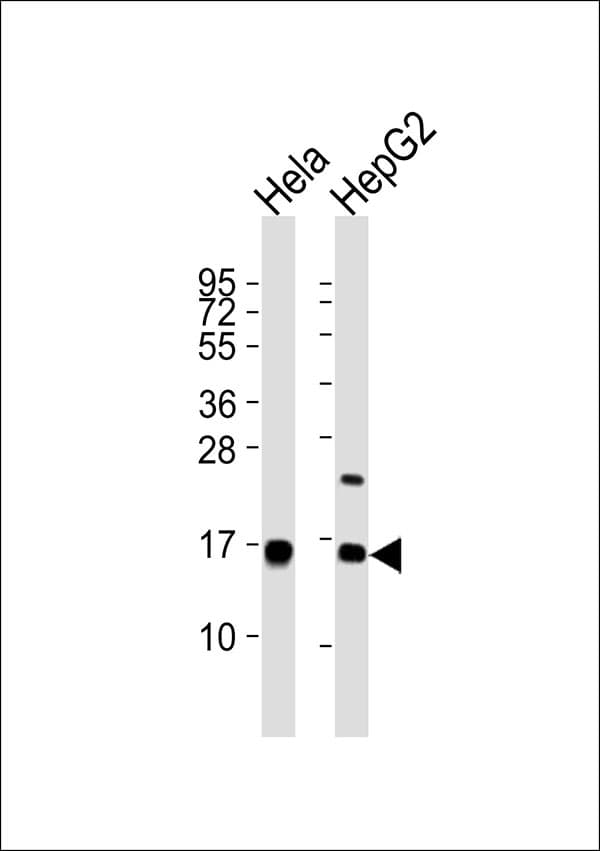 Polyclonal Rabbit anti-Human UBE2D2 / UBCH5B Antibody (WB)