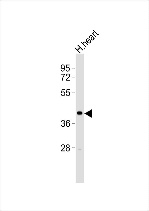 ZADH2 Antibody