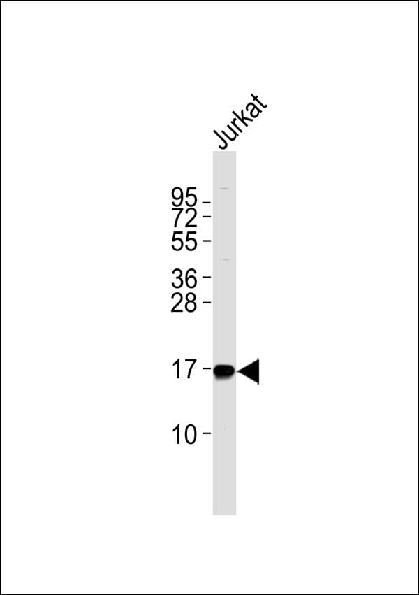 Polyclonal Rabbit anti-Human NBL1 / DAN Antibody (WB)