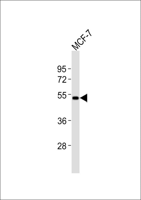 Polyclonal Rabbit anti-Human FUT3 Antibody (WB)