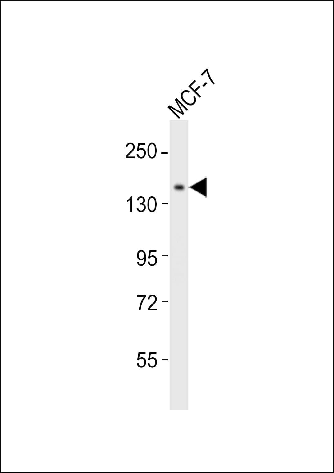 Polyclonal Rabbit anti-Human NACAD Antibody (WB)