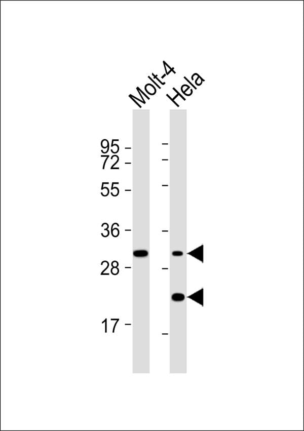 Polyclonal Rabbit anti-Human SMUG1 Antibody (WB)