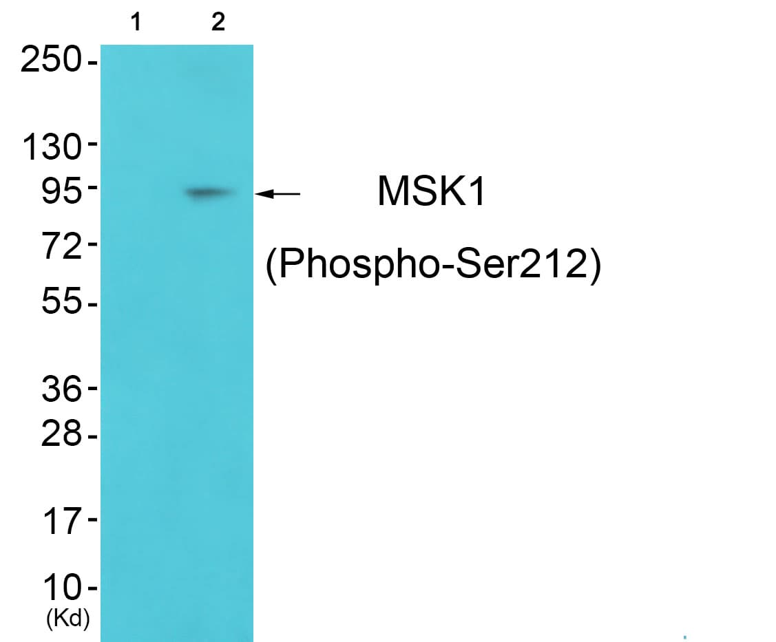 Polyclonal Rabbit anti-Human RPS6KA5 / MSK1 Antibody (phospho-Ser212, IHC, WB)