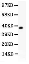 Polyclonal Rabbit anti-Mouse AHSG / Fetuin A Antibody (aa19-345, WB)