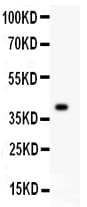 MCM7 Antibody (aa526-719)