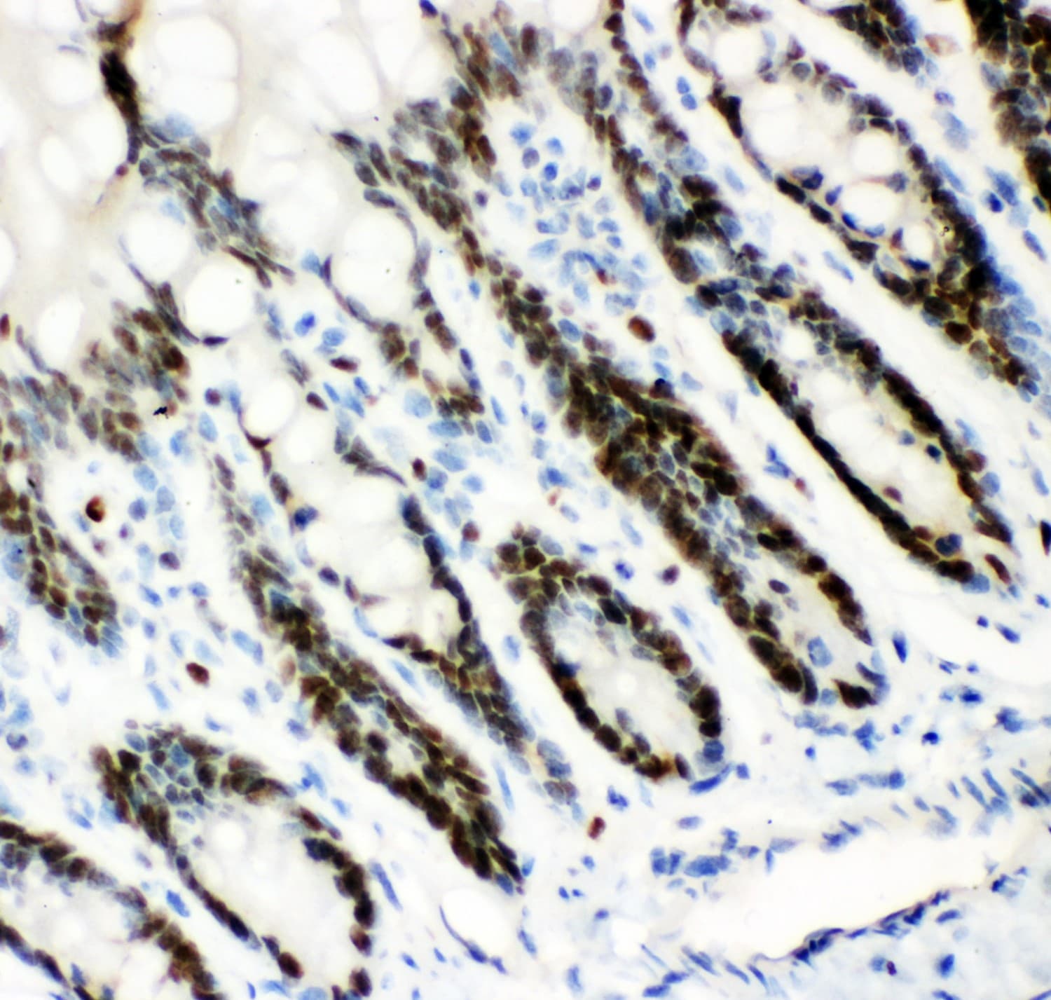 MCM7 Antibody (aa526-719)