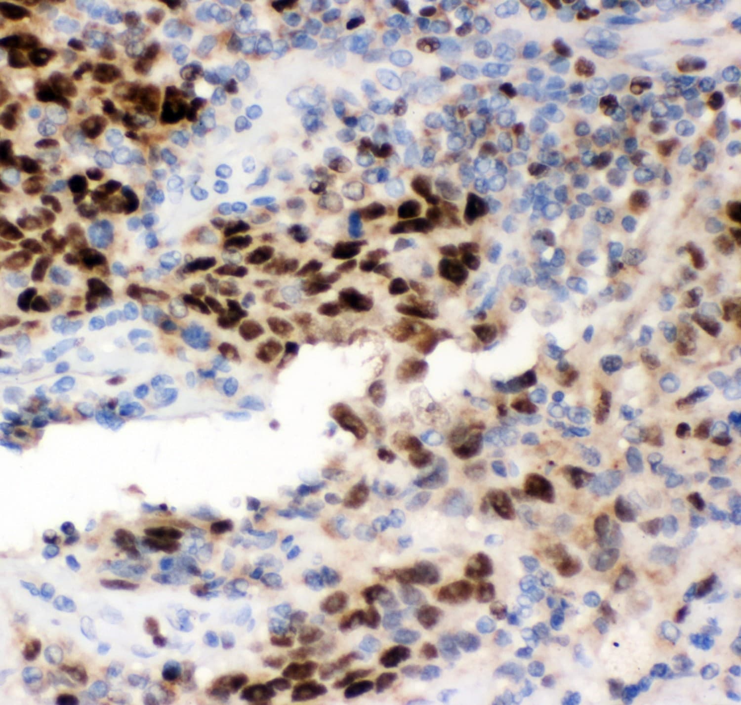 MCM7 Antibody (aa526-719)