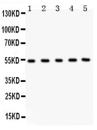 Polyclonal Rabbit anti-Human MMP3 Antibody (aa410-439, WB)