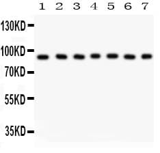 RPS6KA5 / MSK1 Antibody (aa540-665)